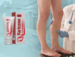 Varicone prospect - beneficii, ingrediente, cum se aplica
